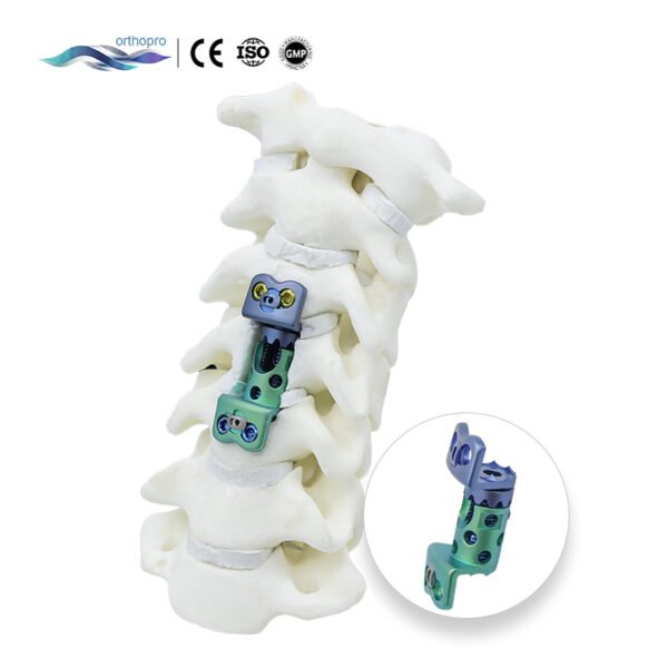 Premium Cervical Expandable Titanium Mesh Cage for ACDF and Corpectomy