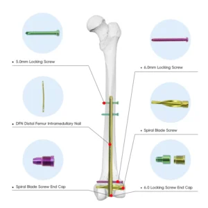 OrthoPro Aluminum DFN Intramedullary Nail Box for sterilization and storage of distal femur orthopedic implants