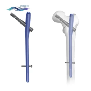 OrthoPro Titanium PFNA Nail system with helical blade for proximal femoral fracture fixation