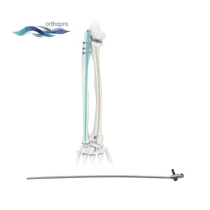 Radius Intramedullary Nail titanium implant for forearm fracture fixation and orthopedic trauma surgery