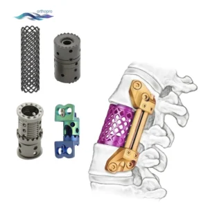 Titanium Mesh Cage System – Vertebral Body Replacement (VBR) Implant for Cervical & Lumbar Corpectomy