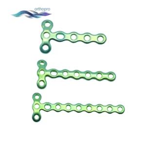 1.5mm Mini Condylar Locking Plate for finger fracture surger