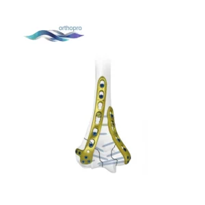 Premium Titanium Distal Lateral Humeral Locking Plate for Orthopedic Trauma Surgery by OrthoPro