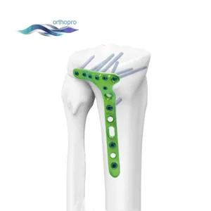 Titanium Distal Lateral Tibial Locking Plate II for orthopedic trauma surgery - OrthoPro