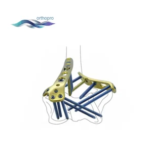 Premium Titanium Distal Medial Humeral Locking Plate for Orthopedic Elbow Trauma Surgery by OrthoPro