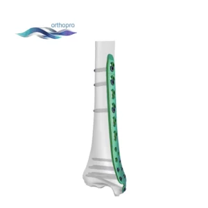 Titanium Distal Medial Tibial Locking Plate I for orthopedic trauma surgery - OrthoPro