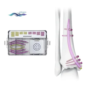 OrthoPro Distal Tibial Intramedullary Nail (DTN) kit for pilon fracture surgery