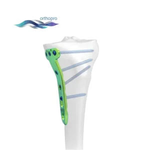 Titanium Proximal Medial Tibial Osteotomy Locking Plate for Open Wedge HTO - OrthoPro