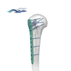 Premium Titanium Proximal Humeral Locking Plate for Orthopedic Shoulder Trauma Surgery by OrthoPro