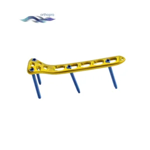 Proximal Radius Locking Plate for Orthopedic Radial Head Fracture Trauma Surgery