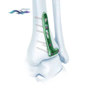 OrthoPro Variable Angle VA Distal Tibia Locking L-Plate for pilon fracture surgery