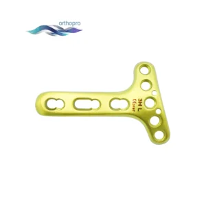 Distal Dorsal Radial Delta Locking Plate top view