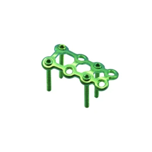 Orthopedic 1.5mm strut plate for spiral fracture fixation
