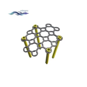 Patella Mesh Locking Plate for multi-fragmentary patellar fracture fixation