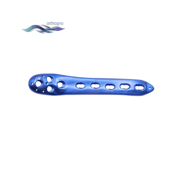 Anatomical Proximal Femoral Locking Plate II for trochanteric fracture fixation